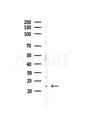IL1F9 Antibody - Western blot analysis of lysates from COLO205 cells, using IL1F9 Antibody at 1/1000 dilution.