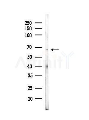 KRT84 Antibody - Western blot analysis of lysates from COLO205 cells, using KRT84 Antibody at 1/1000 dilution.
