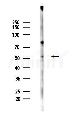 KRT81/86 Antibody - Western blot analysis of lysates from Hela cells(heat-shock,45min treatment), using KRT81/86 Antibody at 1/1000 dilution.