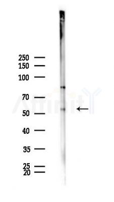 KRT81/86 Antibody - Western blot analysis of lysates from Rat brain, using KRT81/86 Antibody at 1/1000 dilution.