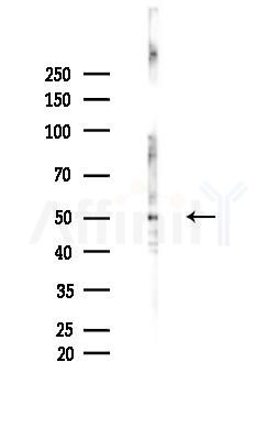 KRT81/86 Antibody - Western blot analysis of lysates from LoVo cells(heat-shock,45min treatment), using KRT81/86 Antibody at 1/1000 dilution.