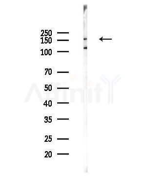 CCNB3 Antibody - Western blot analysis of lysates from PC12 cells(UV,30min treatment), using CCNB3 Antibody at 1/1000 dilution.