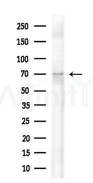 CDC14B/C Antibody - Western blot analysis of extracts from HepG2 cells(heat-shock treatment), using CDC14B/C Antibody at 1/1000 dilution.