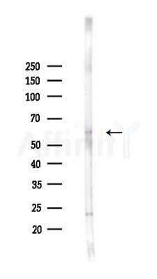 CDC14B/C Antibody - Western blot analysis of lysates from HepG2 cells(heat-shock,45min treatment), using CDC14B/C Antibody at 1/1000 dilution.