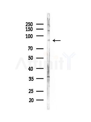 MCM8 Antibody - Western blot analysis of lysates from HepG2 cells(LPS,4h treatment), using MCM8 Antibody at 1/1000 dilution.