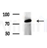 STRN Antibody - Western blot analysis of extracts from EC304 cells(heat-shock treatment), using STRN Antibody at 1/1000 dilution.