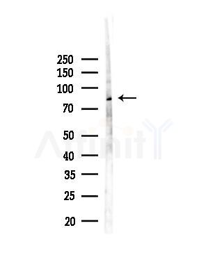 STRN Antibody - Western blot analysis of lysates from EC304 cells(heat-shock,45min treatment), using STRN Antibody at 1/1000 dilution.