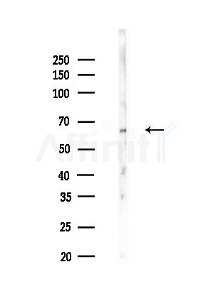 SMARCD1/3 Antibody - Western blot analysis of lysates from B16F10-LUC cells(LPS,4h treatment), using SMARCD1/3 Antibody at 1/1000 dilution.