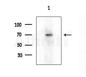 Cytochrome P450 4Z1/2 Antibody - Western blot analysis of extracts from COLO205 cells, using Cytochrome P450 4Z1/2 Antibody at 1/1000 dilution.