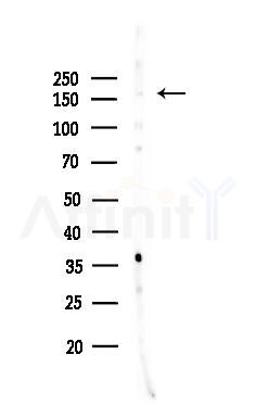 PIK3C2G Antibody - Western blot analysis of lysates from HepG2 cells(heat-shock,45min treatment), using PIK3C2G Antibody at 1/1000 dilution.