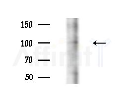 NPR1 Antibody - Western blot analysis of extracts from HepG2 cells(starvation,24h treatment), using NPR1 Antibody at 1/1000 dilution.