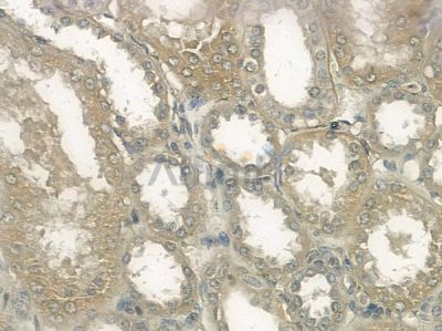 NPR1 Antibody - DF10132 at 1/100 staining human normal kidney tissue by IHC-P.
