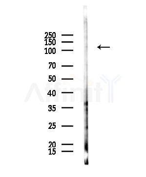NPR1 Antibody - Western blot analysis of lysates from HepG2 cells(starvation,24h treatment), using NPR1 Antibody at 1/1000 dilution.