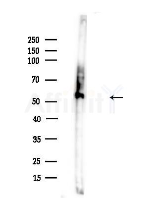 CAMKK1 Antibody - Western blot analysis of lysates from Mouse brain, using CAMKK1 Antibody at 1/1000 dilution.