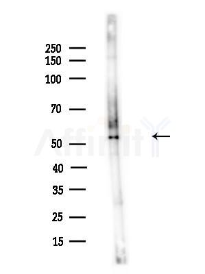 CAMKK1 Antibody - Western blot analysis of lysates from A375 cells(LPS,4h treatment), using CAMKK1 Antibody at 1/1000 dilution.