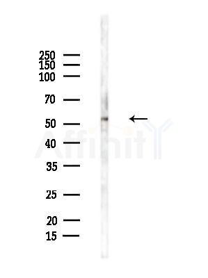 CAMKK1 Antibody - Western blot analysis of lysates from Hela cells(heat-shock,45min treatment), using CAMKK1 Antibody at 1/1000 dilution.