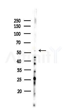 CSNK1G3 Antibody - Western blot analysis of lysates from HepG2 cells(heat-shock,45min treatment), using CSNK1G3 Antibody at 1/1000 dilution.