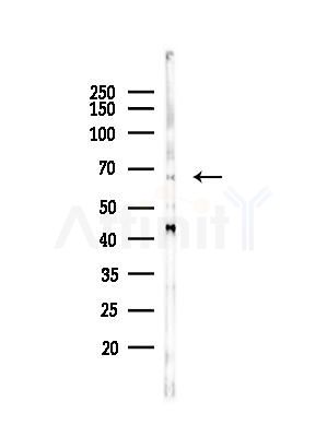 DYRK2 Antibody - Western blot analysis of lysates from B16F10-LUC cells(heat-shock,45min treatment), using DYRK2 Antibody at 1/1000 dilution.