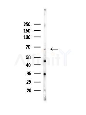 DYRK2 Antibody - Western blot analysis of lysates from Hela cells(heat-shock,45min treatment), using DYRK2 Antibody at 1/1000 dilution.