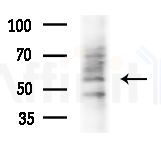 NEK3 Antibody - Western blot analysis of extracts from HepG2 cells(starvation treatment), using NEK3 Antibody at 1/1000 dilution.
