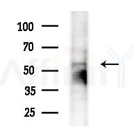 NEK3 Antibody - Western blot analysis of extracts from Mouse testis, using NEK3 Antibody at 1/1000 dilution.