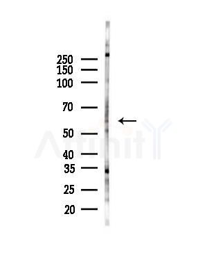NEK3 Antibody - Western blot analysis of lysates from HepG2 cells(starvation,24h treatment), using NEK3 Antibody at 1/1000 dilution.