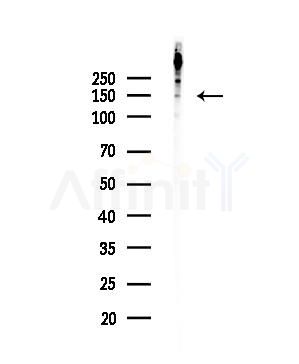 SIK2 Antibody - Western blot analysis of lysates from EC304 cells, using SIK2 Antibody at 1/1000 dilution.