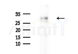 TSSK6 Antibody - Western blot analysis of extracts from Mouse liver, using TSSK6 Antibody at 1/1000 dilution.