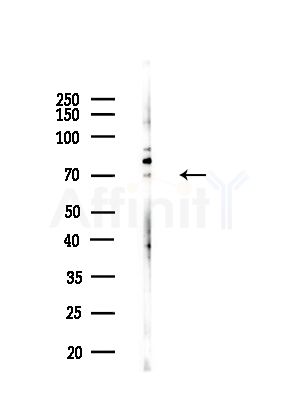 TXK Antibody - Western blot analysis of lysates from B16(LPS, 4h treatment), using TXK Antibody at 1/1000 dilution.