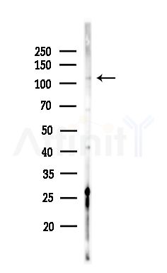 APOB48R Antibody - Western blot analysis of lysates from HepG2 cells(heat-shock,45min treatment), using APOB48R Antibody at 1/1000 dilution.