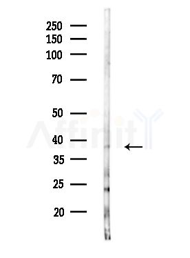 CEACAM8 Antibody - Western blot analysis of lysates from MDA-MB-231 cells(heat-shock,45min treatment), using CEACAM8 Antibody at 1/1000 dilution.