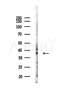 CEACAM8 Antibody - Western blot analysis of lysates from Mouse lung, using CEACAM8 Antibody at 1/1000 dilution.