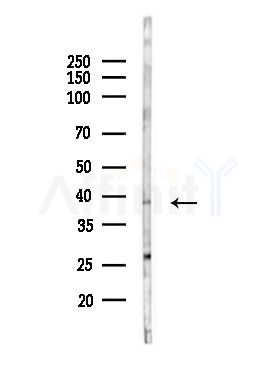 CEACAM8 Antibody - Western blot analysis of lysates from LOV0(heat-shock,45min treatment), using CEACAM8 Antibody at 1/1000 dilution.