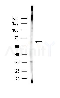 LILRB5 Antibody - Western blot analysis of lysates from HepG2 cells(heat-shock,45min treatment), using LILRB5 Antibody at 1/1000 dilution.