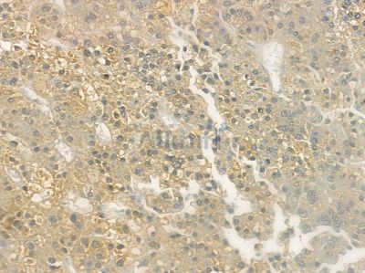 KLRC2/4 Antibody - DF10154 at 1/100 staining rat lung tissue by IHC-P.