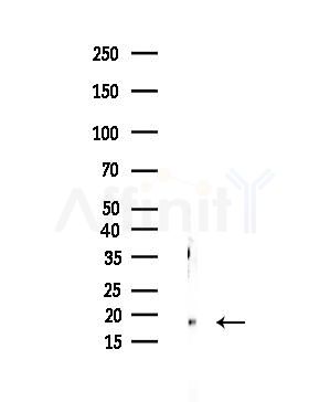 KLRC2/4 Antibody - Western blot analysis of lysates from EC304 cells, using KLRC2/4 Antibody at 1/1000 dilution.