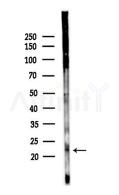 IL28A Antibody - Western blot analysis of lysates from HepG2 cells(heat-shock,45min treatment), using IL28A Antibody at 1/1000 dilution.