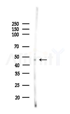RGMB Antibody - Western blot analysis of lysates from Rat liver, using RGMB Antibody at 1/1000 dilution.