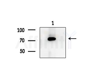 COLEC12 Antibody - Western blot analysis of extracts from COLO205 cells, using COLEC12 Antibody at 1/1000 dilution.