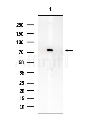 COLEC12 Antibody - Western blot analysis of extracts from EC304 cells, using COLEC12 Antibody at 1/1000 dilution.