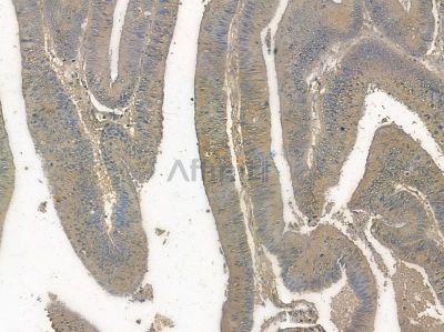 COLEC12 Antibody - DF10165 at 1/100 staining mouse heart tissue by IHC-P.