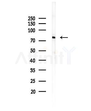 COLEC12 Antibody - Western blot analysis of lysates from EC304 cells, using COLEC12 Antibody at 1/1000 dilution.