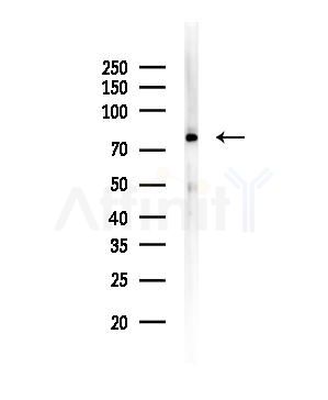 COLEC12 Antibody - Western blot analysis of lysates from COLO205 cells, using COLEC12 Antibody at 1/1000 dilution.