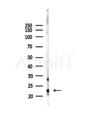 CDO1 Antibody - Western blot analysis of lysates from B16F10-LUC cells(heat-shock,45min treatment), using CDO1 Antibody at 1/1000 dilution.
