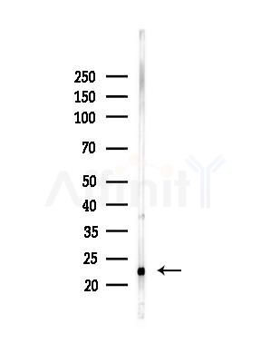 CDO1 Antibody - Western blot analysis of lysates from Hela cells(heat-shock,45min treatment), using CDO1 Antibody at 1/1000 dilution.