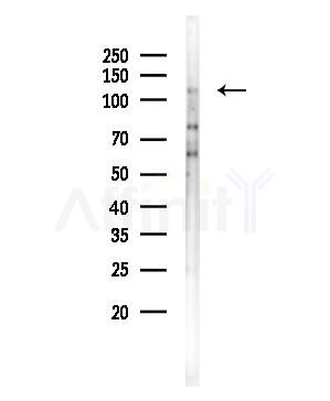 SEMA6D Antibody - Western blot analysis of lysates from COLO205 cells, using SEMA6D Antibody at 1/1000 dilution.