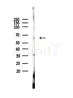 LINGO2 Antibody - Western blot analysis of lysates from EC304 cells(heat-shock, 45min treatment), using LINGO2 Antibody at 1/1000 dilution.