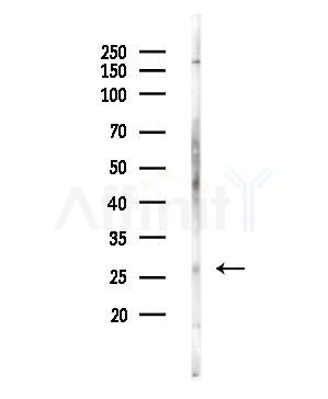 PLUNC Antibody - Western blot analysis of lysates from EC304 cells, using PLUNC Antibody at 1/1000 dilution.