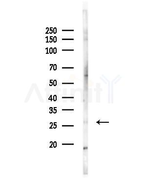PLUNC Antibody - Western blot analysis of lysates from COLO205 cells, using PLUNC Antibody at 1/1000 dilution.