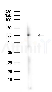 ENOSF1 Antibody - Western blot analysis of lysates from Hela cells(heat-shock,45min treatment), using ENOSF1 Antibody at 1/1000 dilution.
